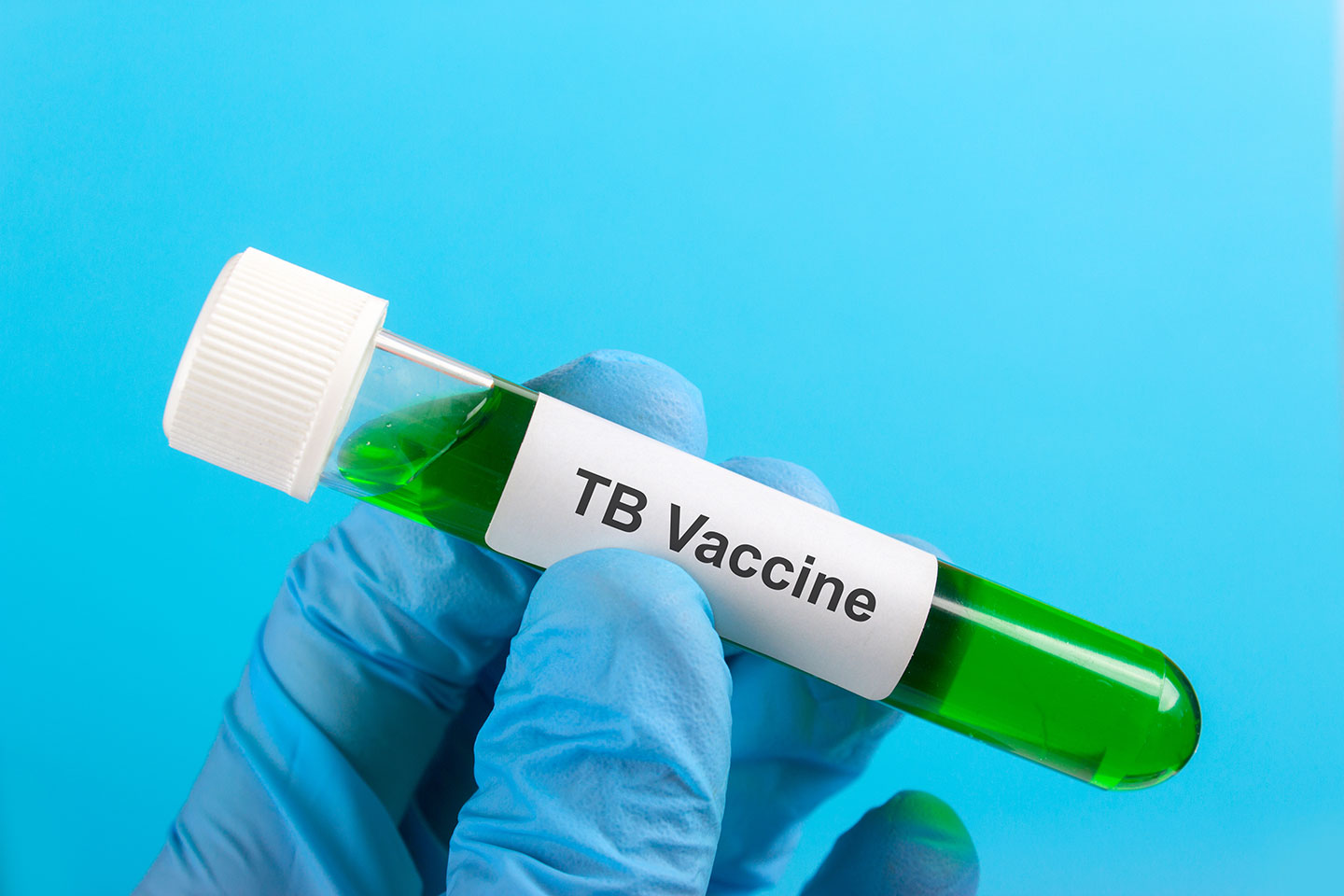 New TB Vaccines Could Avert 7.3 Million Deaths by 2050, Gavi Reports